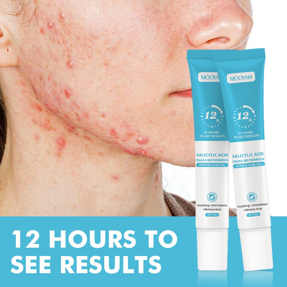 Transboundary hydrochloric acetic acid paste diluted printed to powdered closed-mouth shrink capsule plant essence gel
